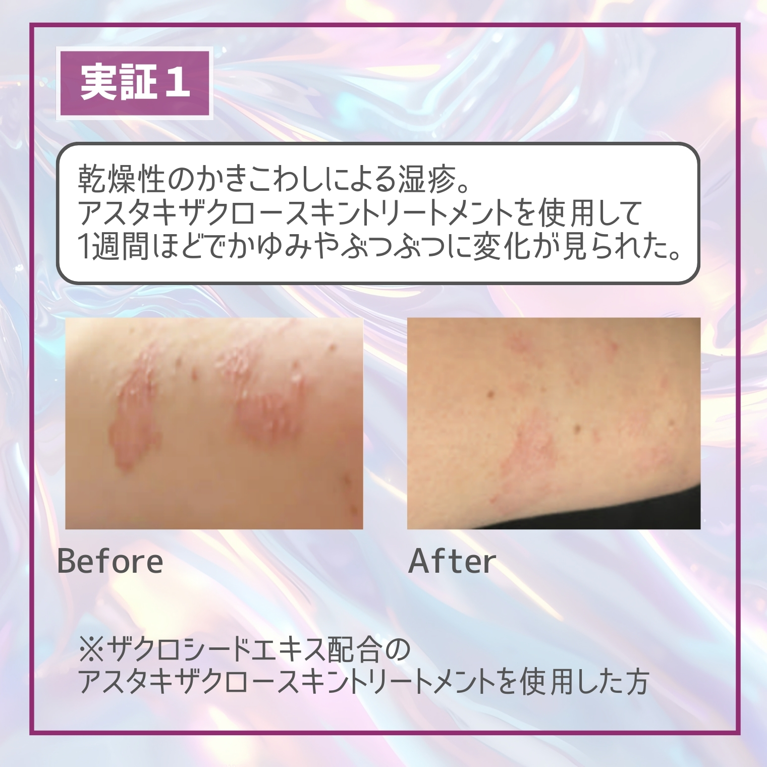 tinccs (ティンクス）シャンプー