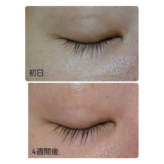 プロショット ラッシュセラム